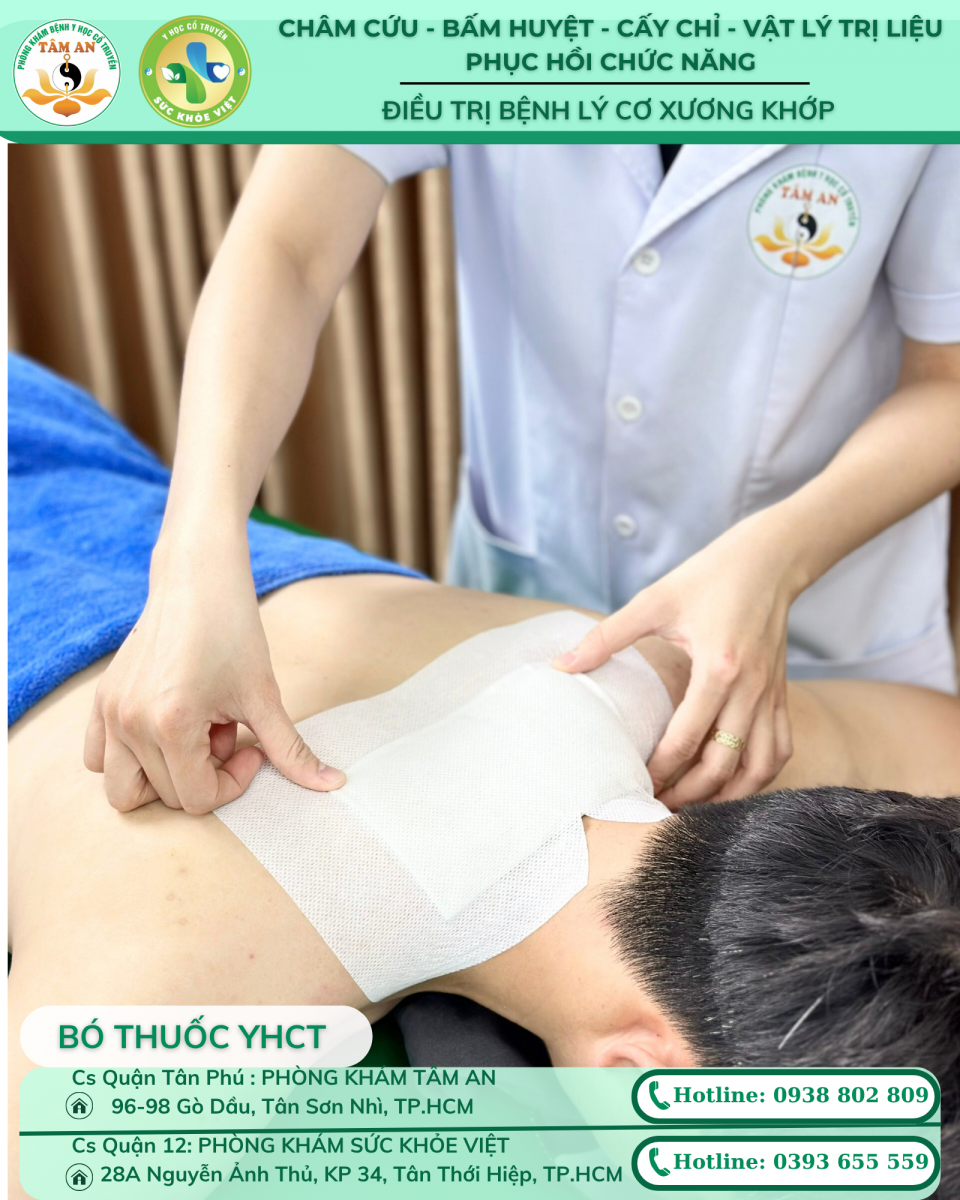 bó thuốc bong gân