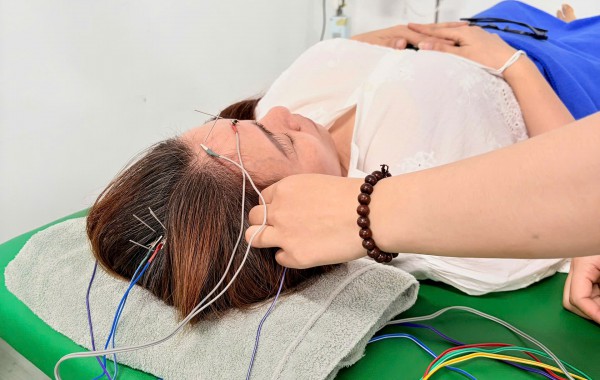 Tại sao sau khi châm cưu về đau hơn lúc đầu?