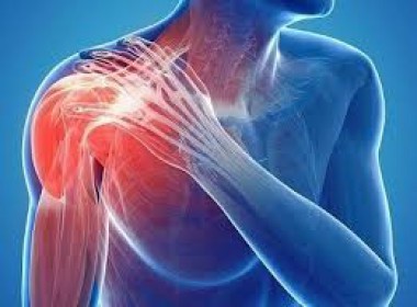 Viêm khớp vai là gì
